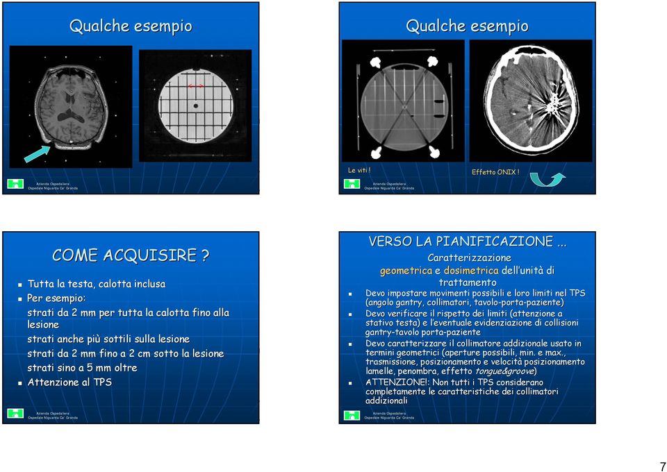 mm oltre Attenzione al TPS VERSO LA PIANIFICAZIONE.