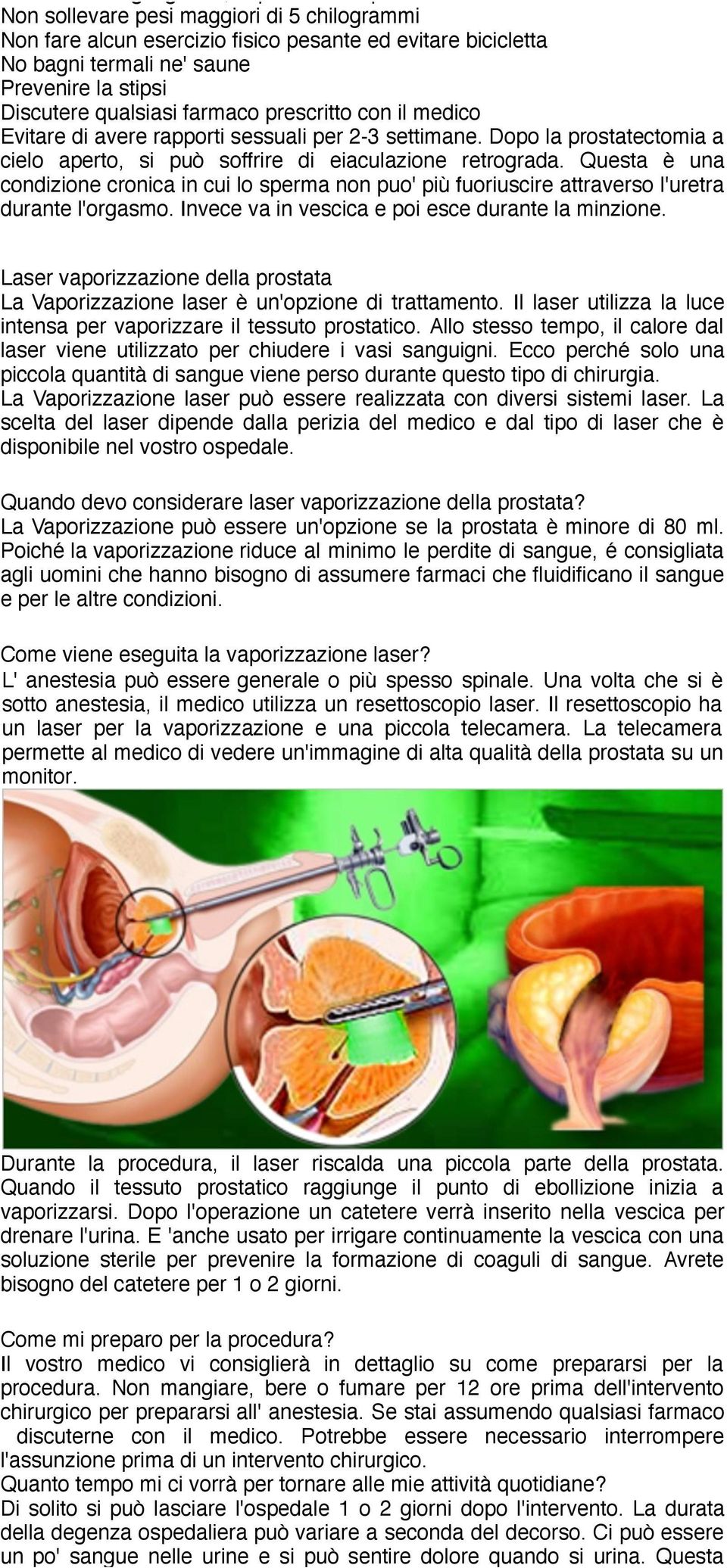 Questa è una condizione cronica in cui lo sperma non puo' più fuoriuscire attraverso l'uretra durante l'orgasmo. Invece va in vescica e poi esce durante la minzione.