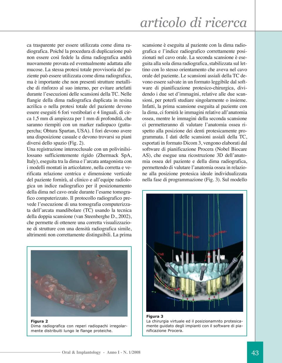 La stessa protesi totale provvisoria del paziente può essere utilizzata come dima radiografica, ma è importante che non presenti strutture metalliche di rinforzo al suo interno, per evitare artefatti