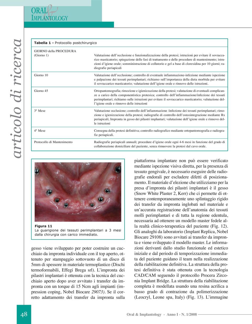 L impronta dei pilastri implantari è ottenuta con la tecnica del cucchiaio aperto dopo aver avvitato i transfer da impronta con un torque di 15 Ncm agli impianti (impression coping, Nobel Biocare