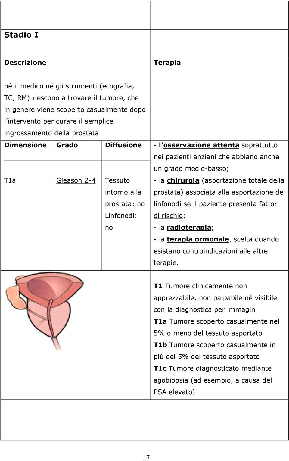 grado medio-basso; - la chirurgia (asportazione totale della prostata) associata alla asportazione dei linfonodi se il paziente presenta fattori di rischio; - la radioterapia; - la terapia ormonale,