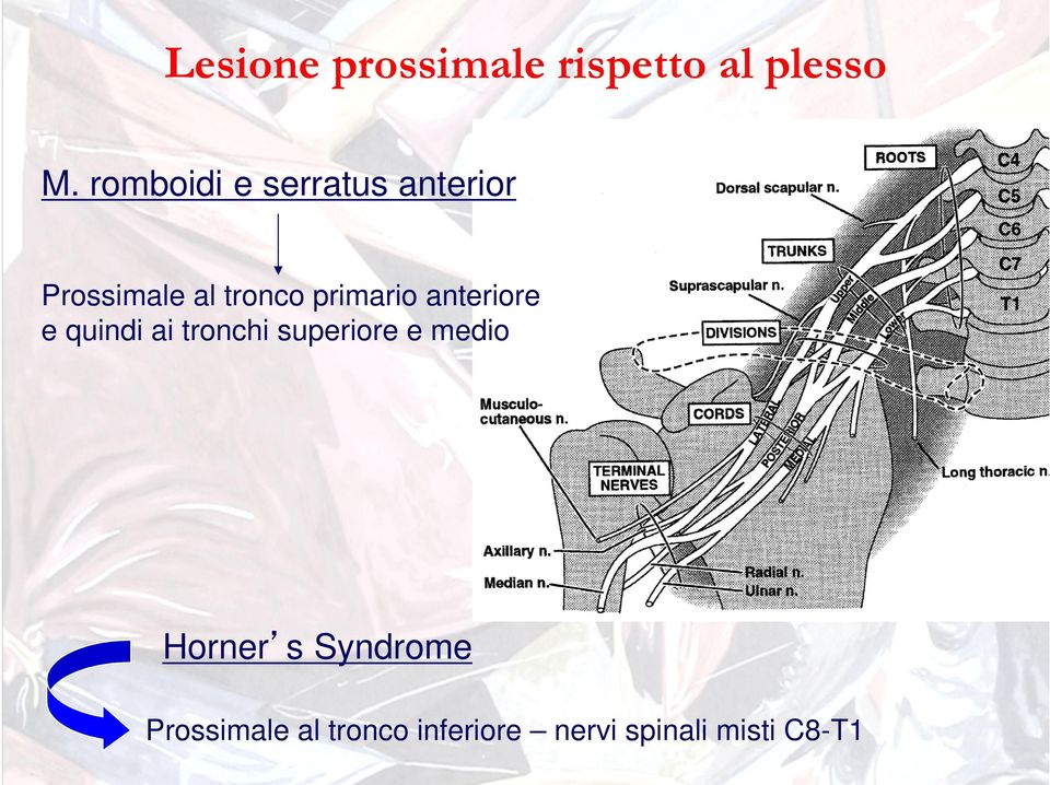 primario anteriore e quindi ai tronchi superiore e