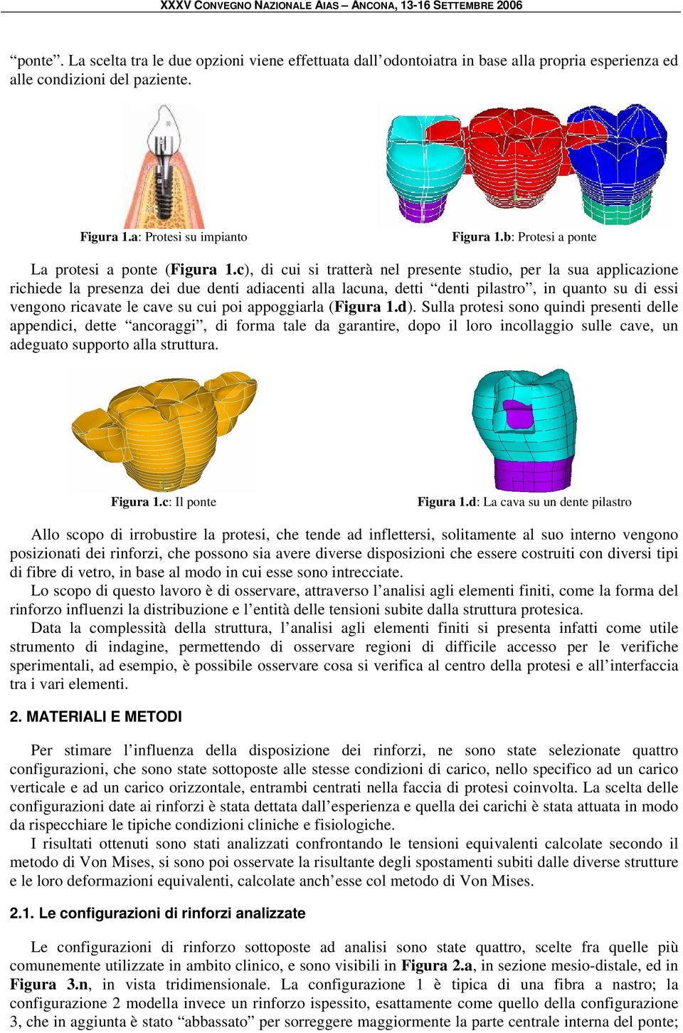 c), di cui si tratterà nel presente studio, per la sua applicazione richiede la presenza dei due denti adiacenti alla lacuna, detti denti pilastro, in quanto su di essi vengono ricavate le cave su