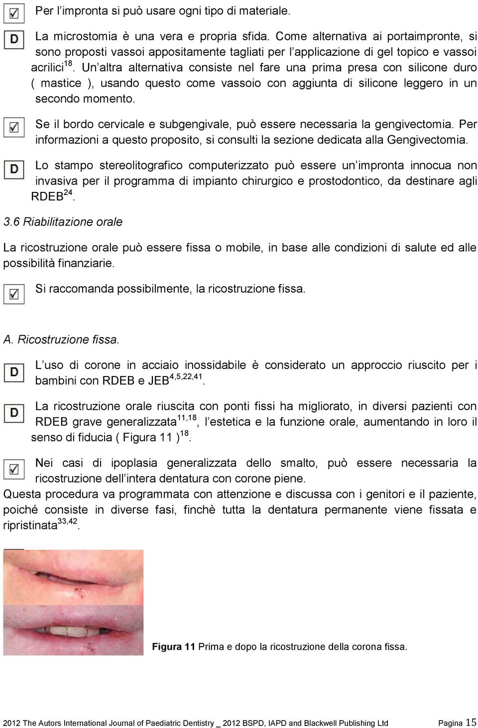 Un altra alternativa consiste nel fare una prima presa con silicone duro ( mastice ), usando questo come vassoio con aggiunta di silicone leggero in un secondo momento.