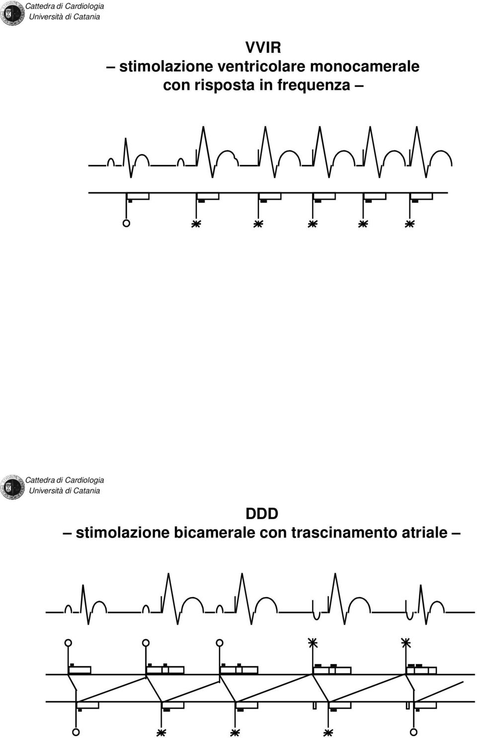 frequenza DDD stimolazione