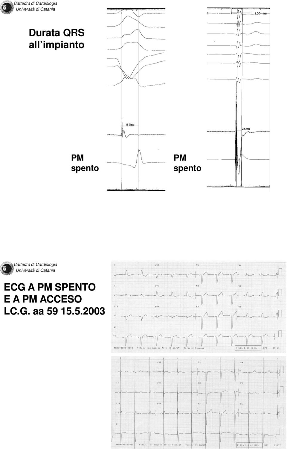 A PM SPENTO E A PM