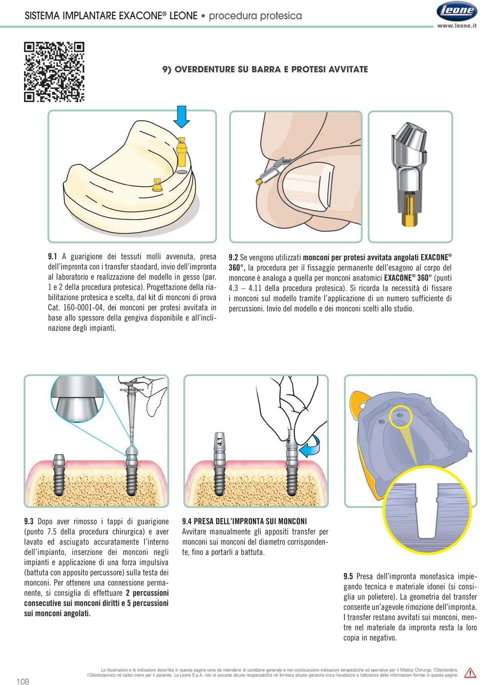 Progettazione della riabilitazione protesica e scelta, dal kit di monconi di prova Cat.