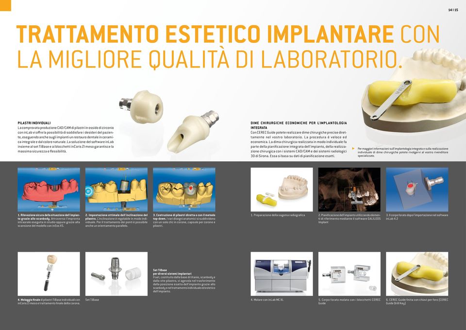 restauro dentale in ceramica integrale e dal colore naturale. La soluzione del software inlab insieme al set TiBase e ai blocchetti incoris ZI meso garantisce la massima sicurezza e flessibilità.