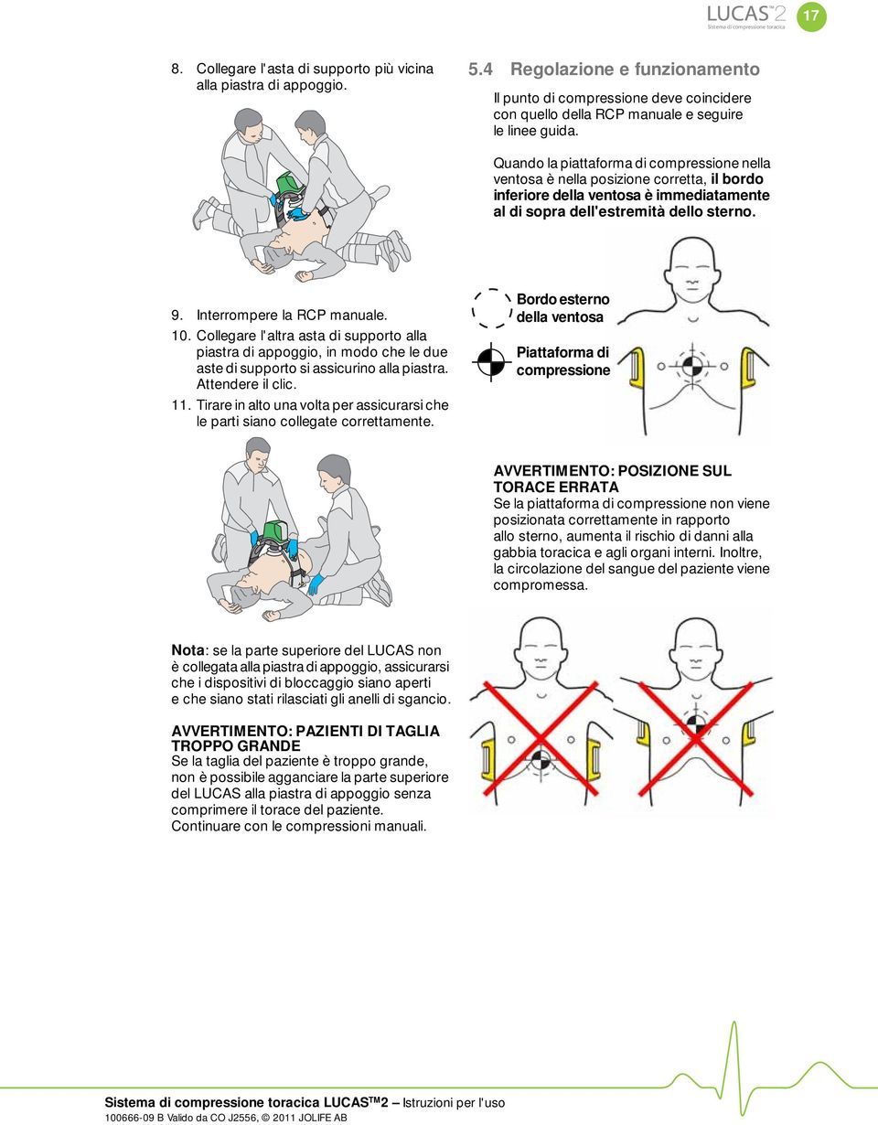 Quando la piattaforma di compressione nella ventosa è nella posizione corretta, il bordo inferiore della ventosa è immediatamente al di sopra dell'estremità dello sterno. 9.