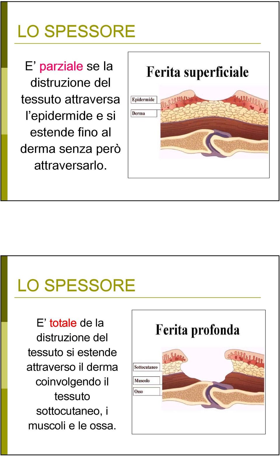 LO SPESSORE E totale de la distruzione del tessuto si estende