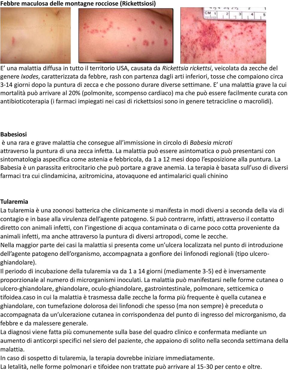 E una malattia grave la cui mortalità può arrivare al 20% (polmonite, scompenso cardiaco) ma che può essere facilmente curata con antibioticoterapia (i farmaci impiegati nei casi di rickettsiosi sono