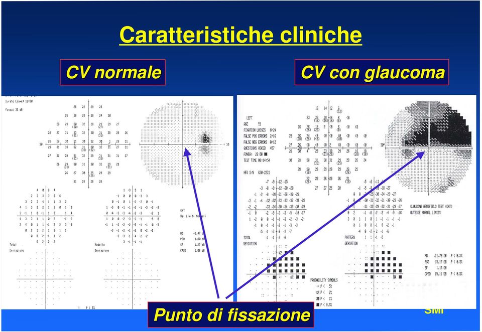 normale CV con