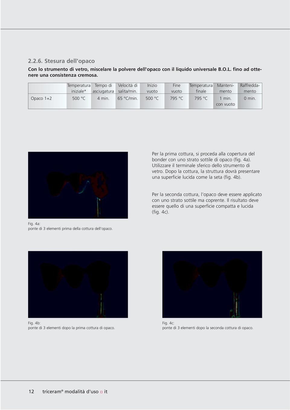 0 min. Per la prima cottura, si proceda alla copertura del bonder con uno strato sottile di opaco (fig. 4a). Utilizzare il terminale sferico dello strumento di vetro.