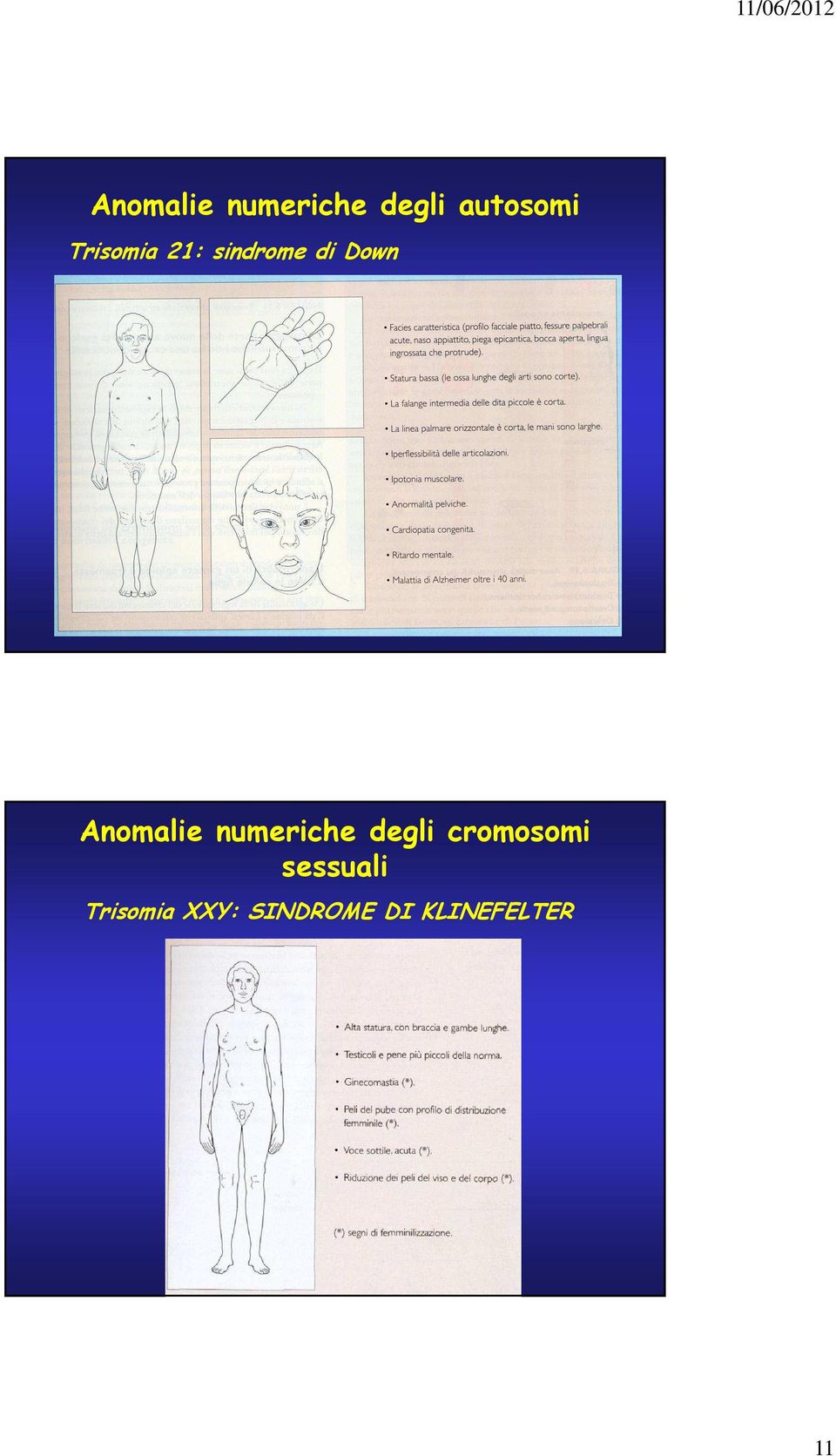 Anomalie numeriche degli cromosomi