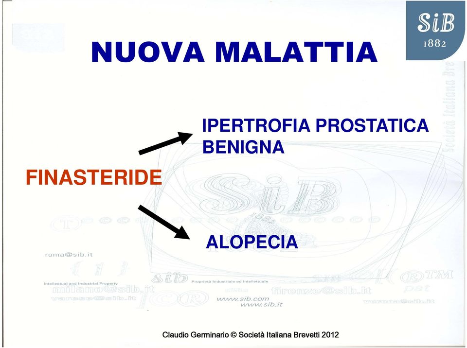 IPERTROFIA