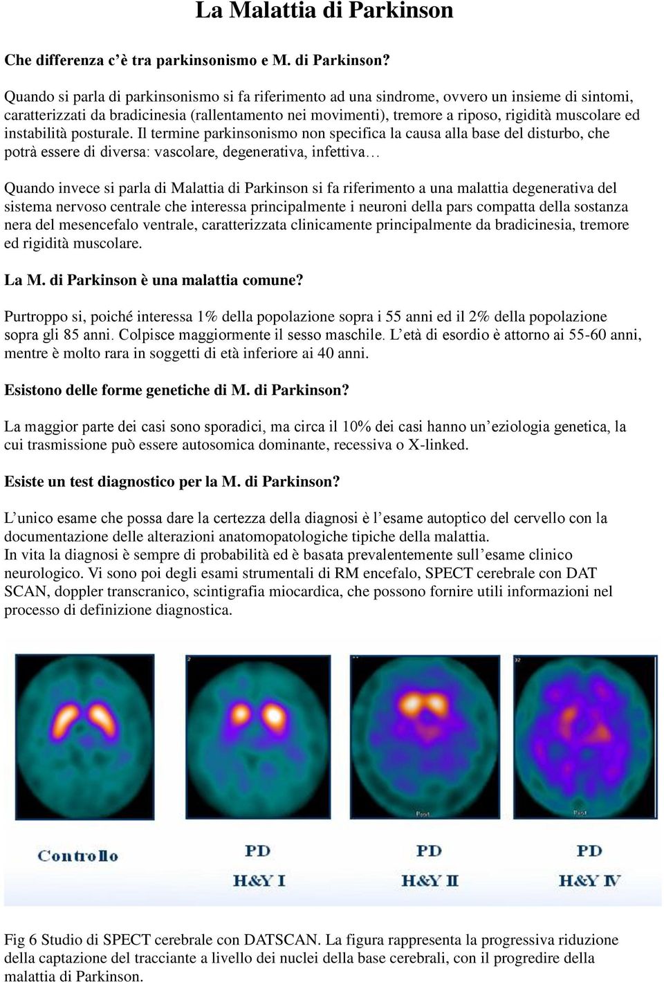 Quando si parla di parkinsonismo si fa riferimento ad una sindrome, ovvero un insieme di sintomi, caratterizzati da bradicinesia (rallentamento nei movimenti), tremore a riposo, rigidità muscolare ed