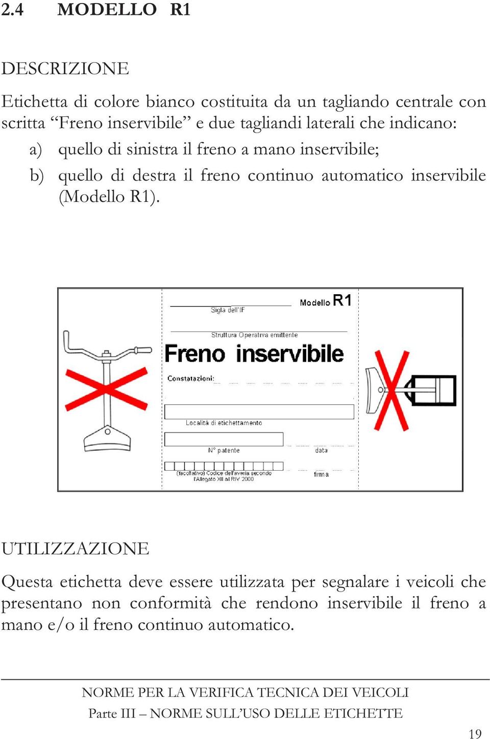 destra il freno continuo automatico inservibile (Modello R1).