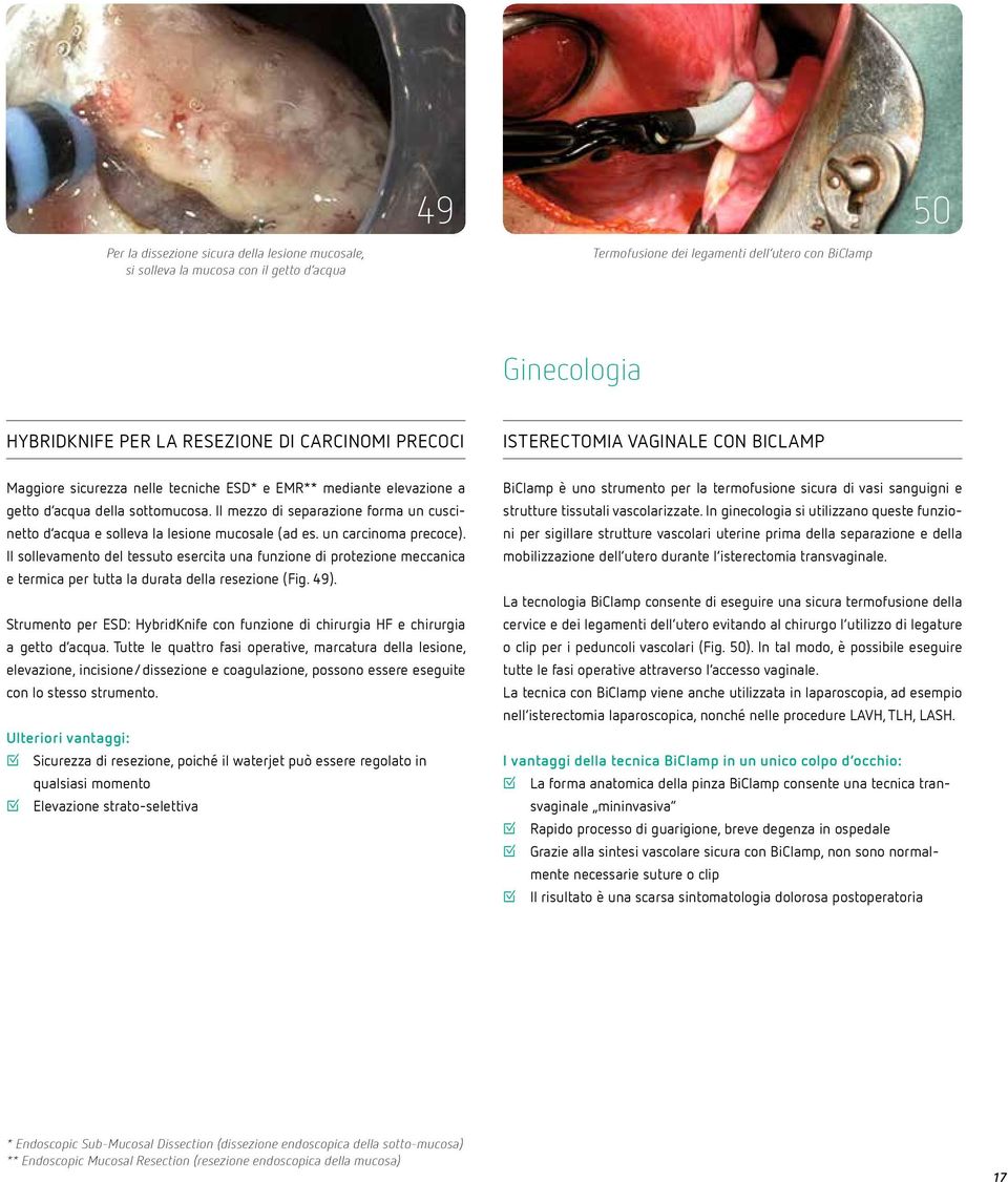 Il mezzo di separazione forma un cuscinetto d acqua e solleva la lesione mucosale (ad es. un carcinoma precoce).