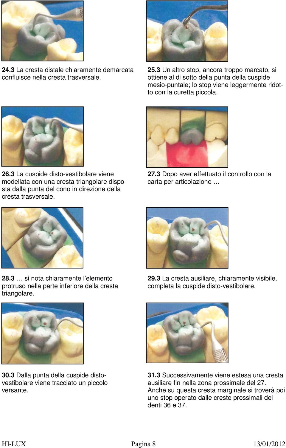 3 Dopo aver effettuato il controllo con la modellata con una cresta triangolare dispo- carta per articolazione sta dalla punta del cono in direzione della cresta trasversale. 28.