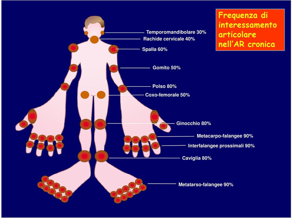 50% Polso 80% Coxo-femorale 50% Ginocchio 80%
