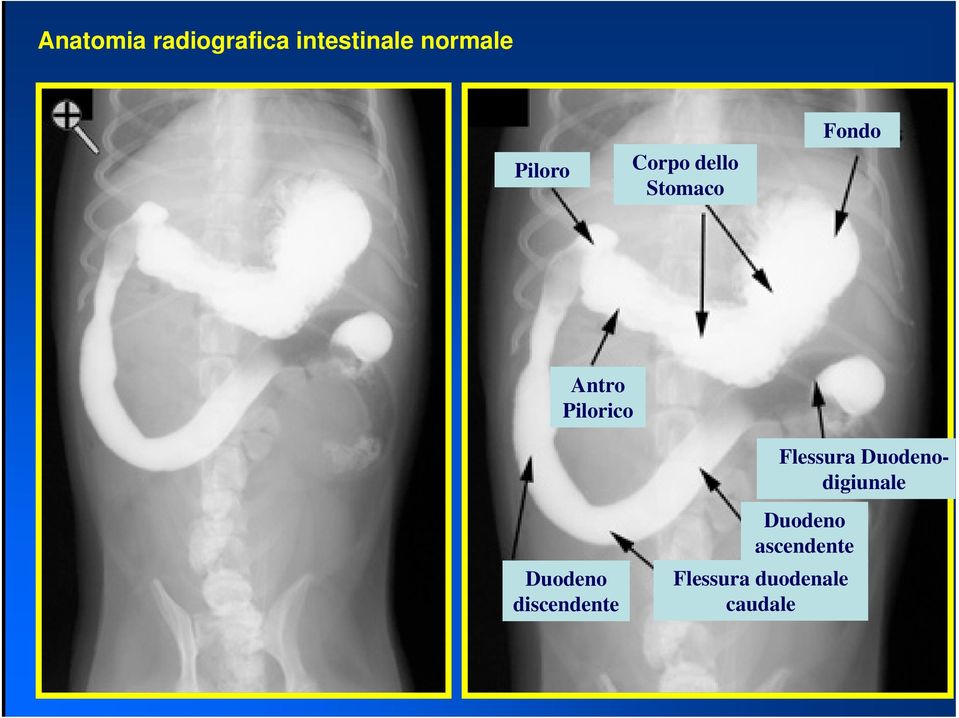 Pilorico Flessura Duodenodigiunale Duodeno