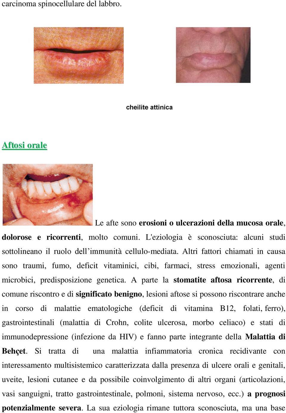 Altri fattori chiamati in causa sono traumi, fumo, deficit vitaminici, cibi, farmaci, stress emozionali, agenti microbici, predisposizione genetica.