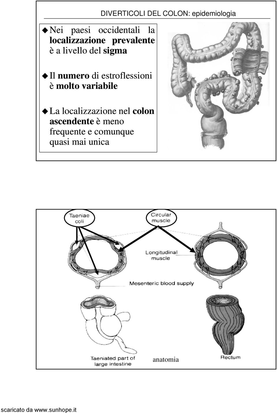 localizzazione li i nel colon ascendente è meno frequente e