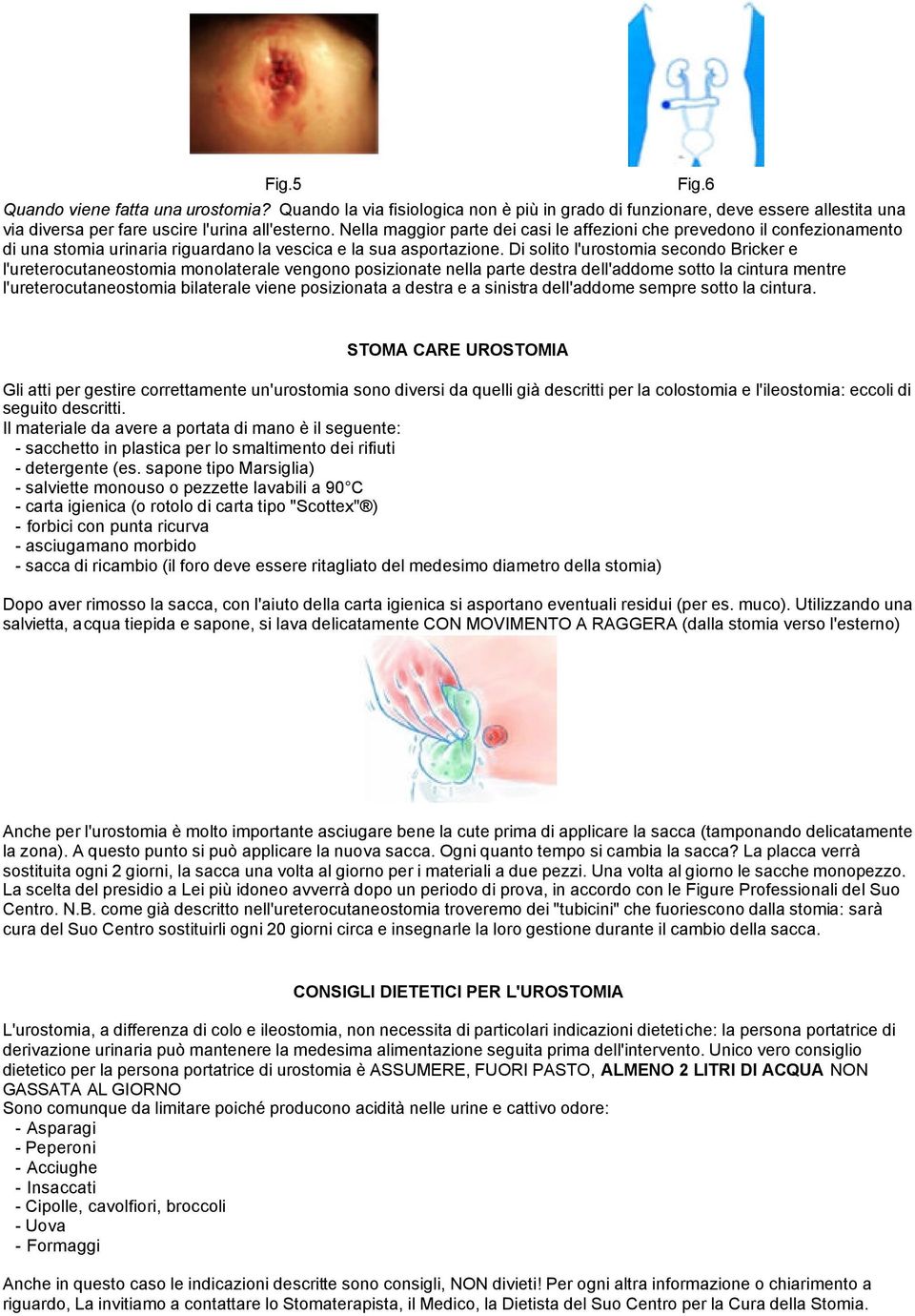 Di solito l'urostomia secondo Bricker e l'ureterocutaneostomia monolaterale vengono posizionate nella parte destra dell'addome sotto la cintura mentre l'ureterocutaneostomia bilaterale viene