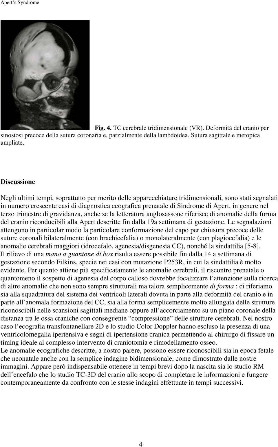 in genere nel terzo trimestre di gravidanza, anche se la letteratura anglosassone riferisce di anomalie della forma del cranio riconducibili alla Apert descritte fin dalla 19a settimana di gestazione.