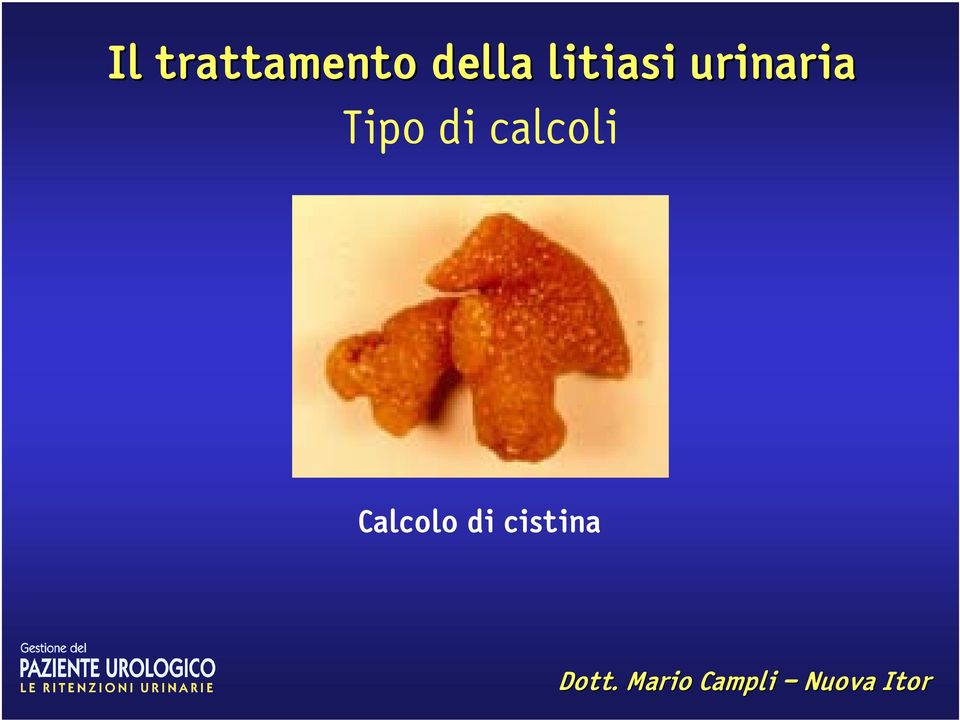 Calcolo