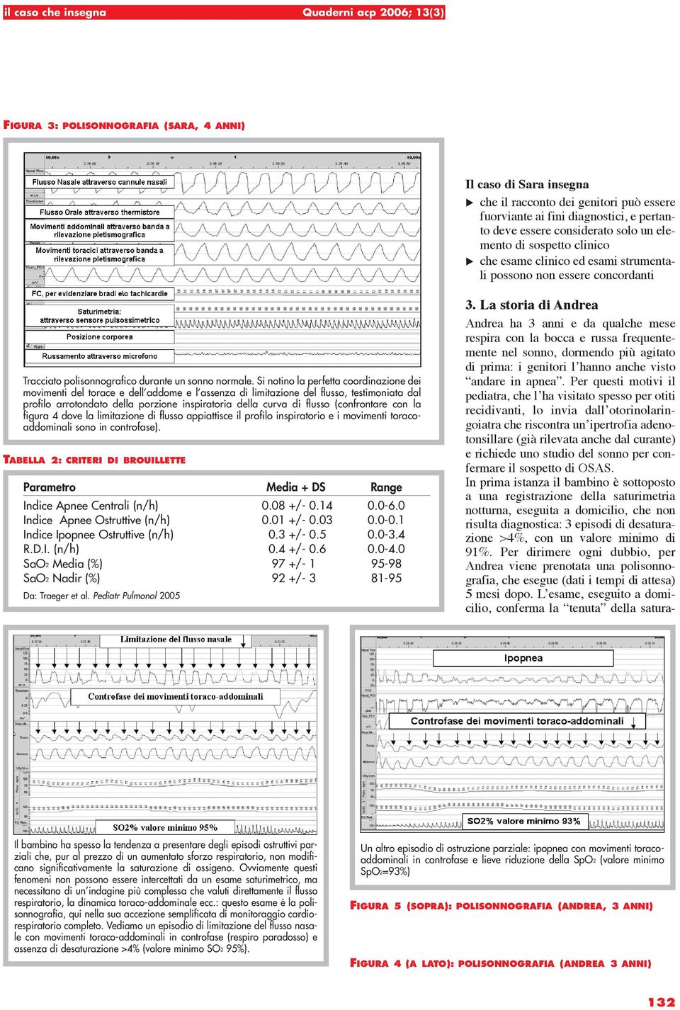 Si notino la perfetta coordinazione dei movimenti del torace e dell addome e l assenza di limitazione del flusso, testimoniata dal profilo arrotondato della porzione inspiratoria della curva di