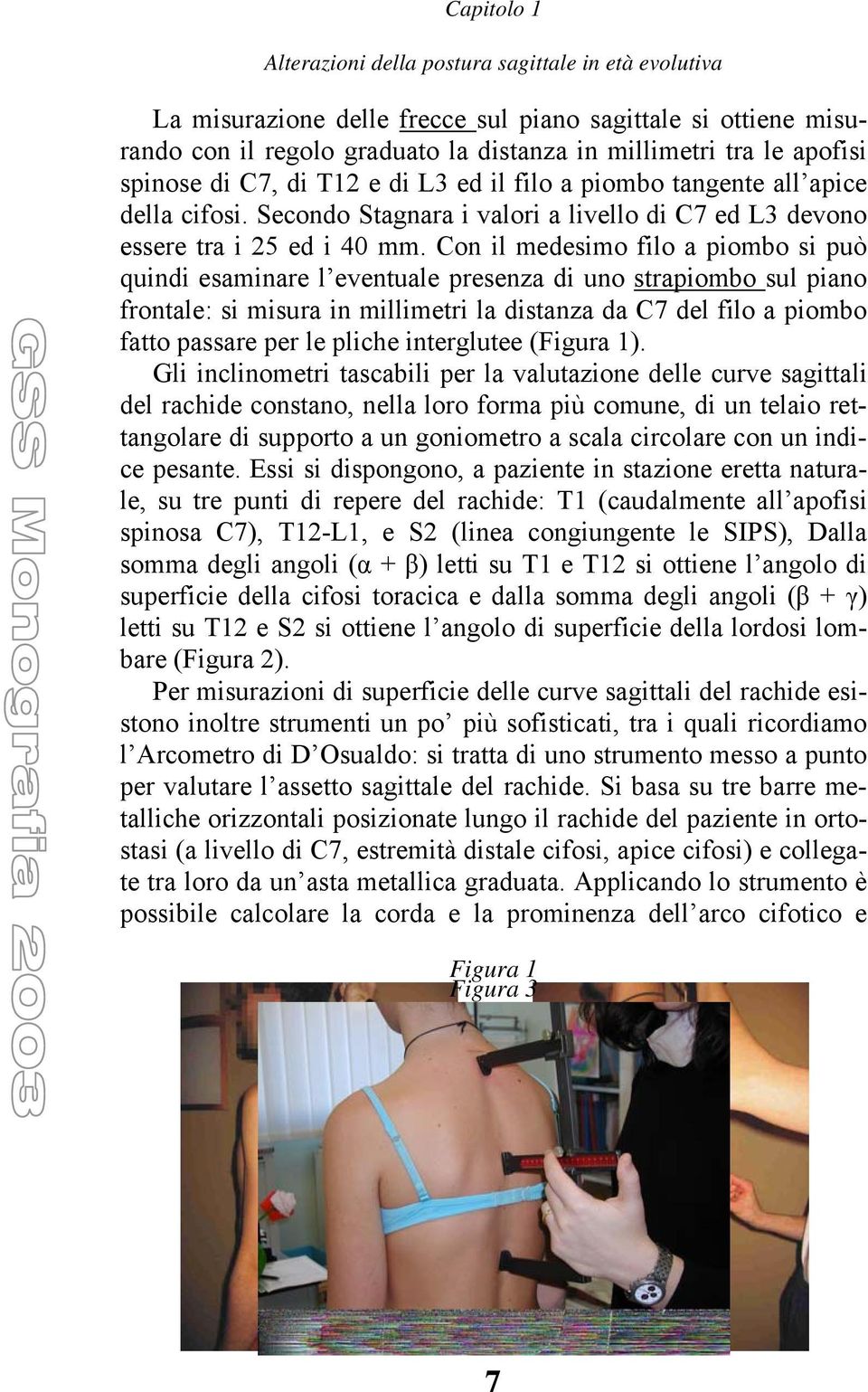 Con il medesimo filo a piombo si può quindi esaminare l eventuale presenza di uno strapiombo sul piano frontale: si misura in millimetri la distanza da C7 del filo a piombo fatto passare per le