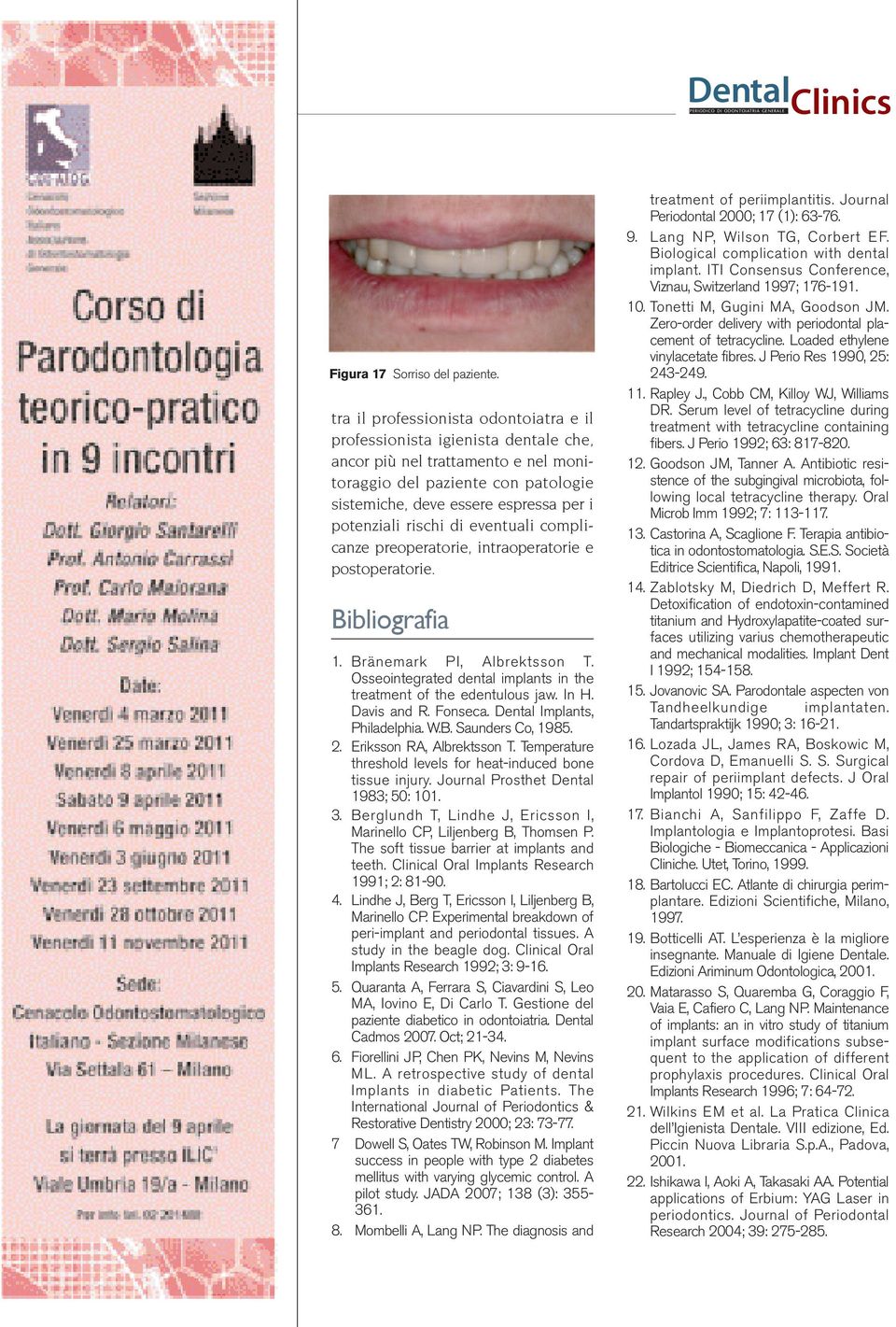 rischi di eventuali complicanze preoperatorie, intraoperatorie e postoperatorie. Bibliografia 1. Bränemark PI, Albrektsson T. Osseointegrated dental implants in the treatment of the edentulous jaw.