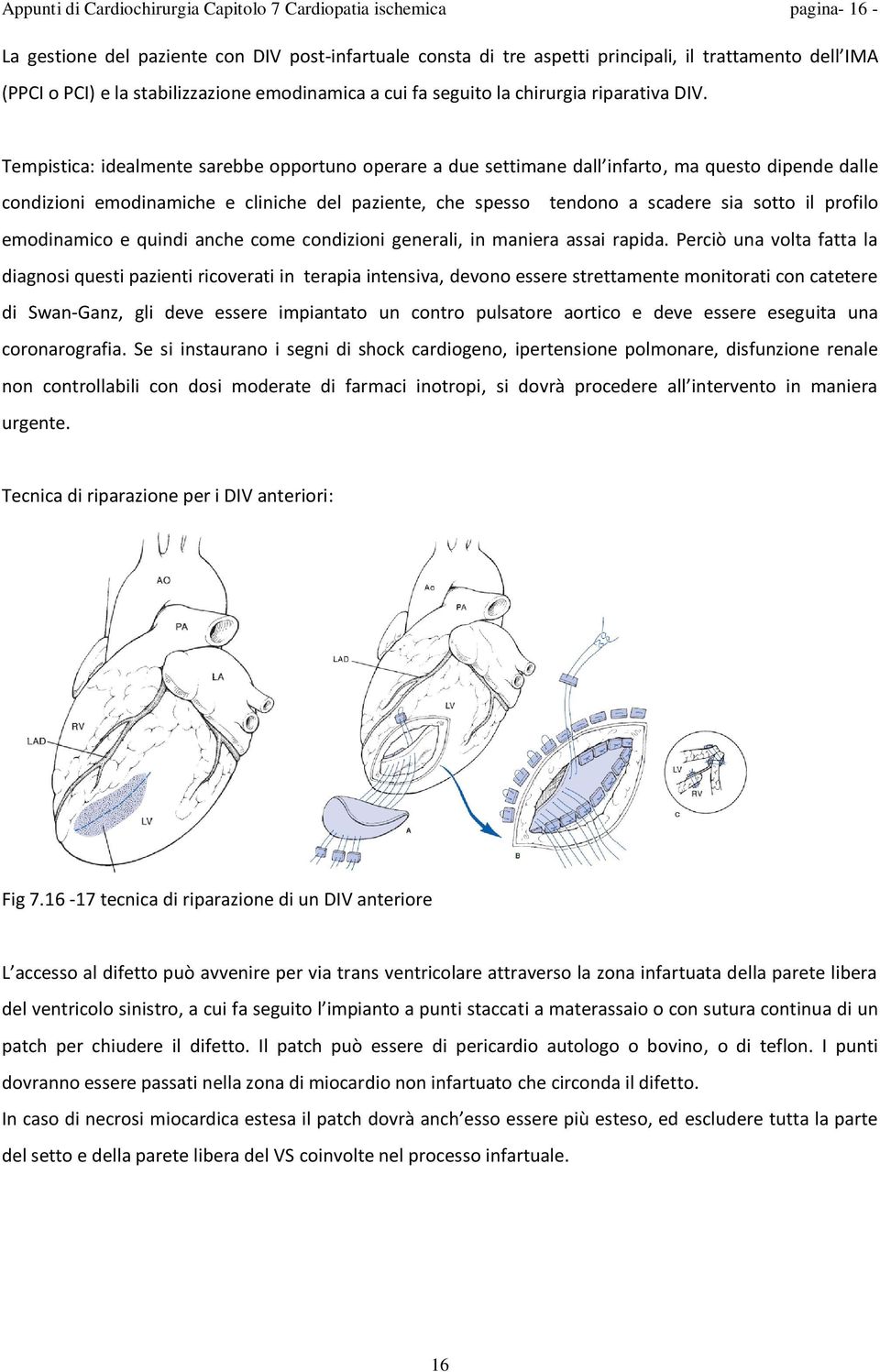 Tempistica: idealmente sarebbe opportuno operare a due settimane dall infarto, ma questo dipende dalle condizioni emodinamiche e cliniche del paziente, che spesso tendono a scadere sia sotto il