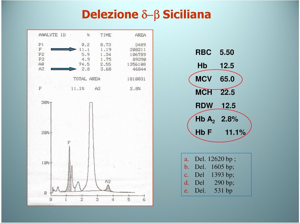 8% Hb F 11.1% a. Del. 12620 bp ; b. Del. 1605 bp; c.