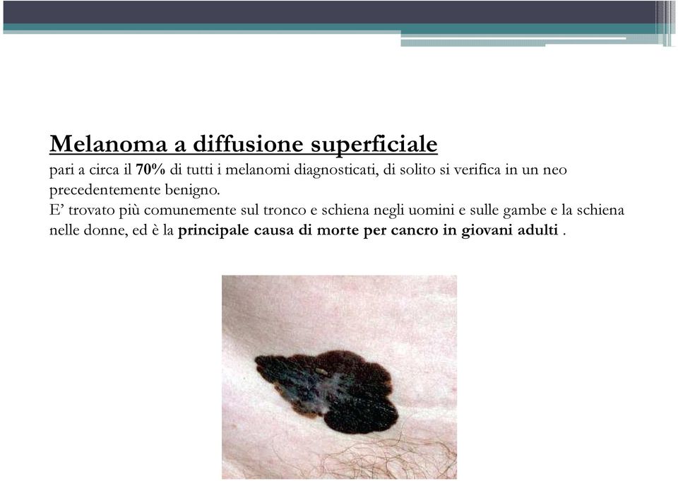 E trovato più comunemente sul tronco e schiena negli uomini e sulle gambe e