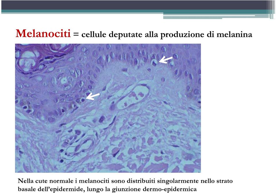 distribuiti singolarmente nello strato basale