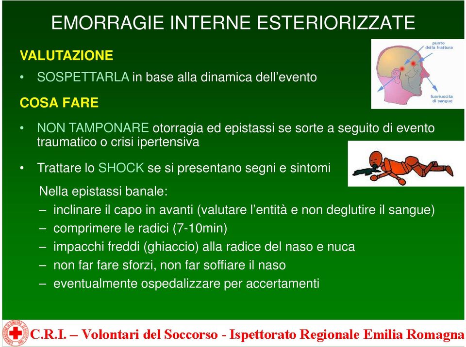 epistassi banale: inclinare il capo in avanti (valutare l entità e non deglutire il sangue) comprimere le radici (7-10min)