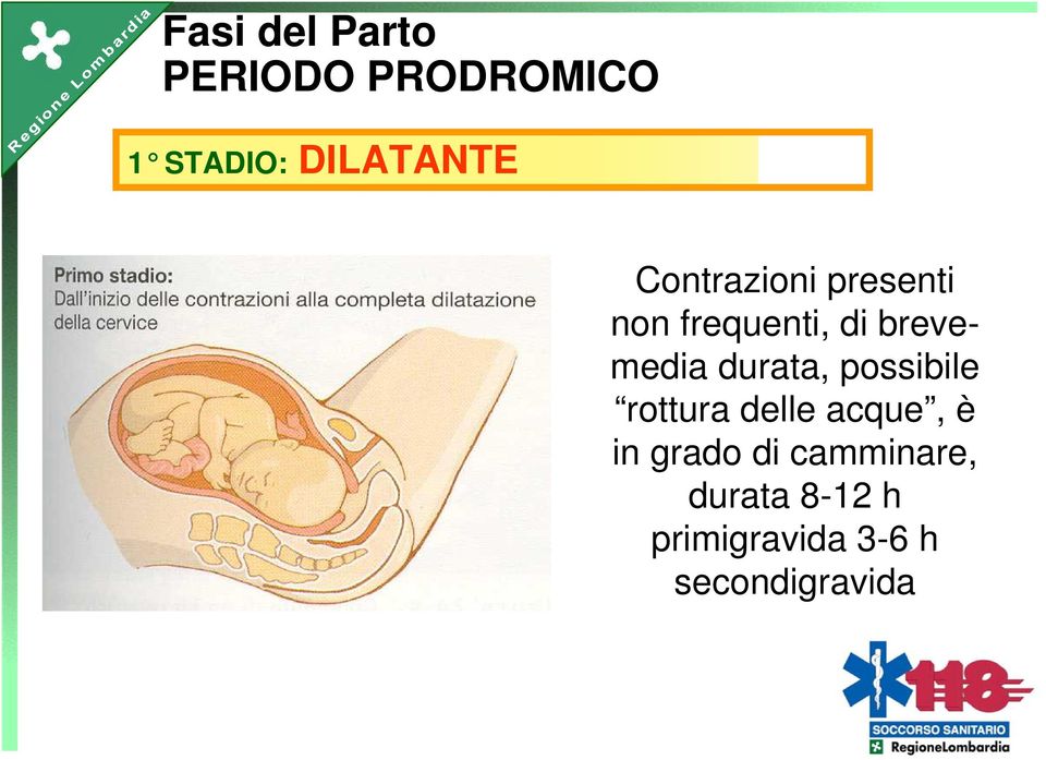 durata, possibile rottura delle acque, è in grado di