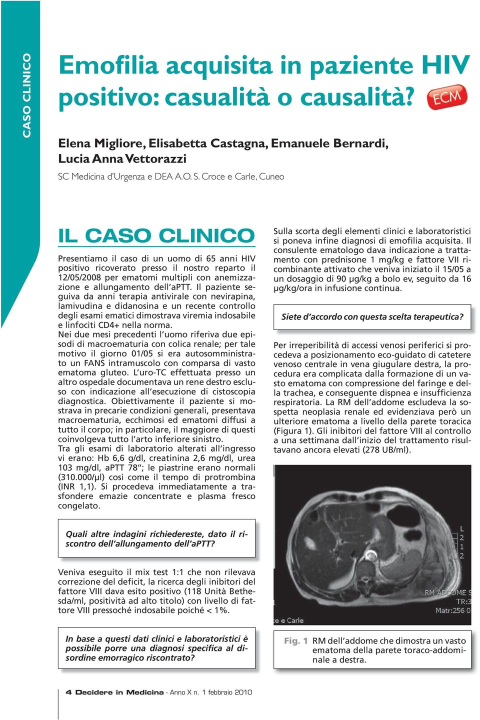 Croce e Carle, Cuneo IL CASO CLINICO Presentiamo il caso di un uomo di 65 anni HIV positivo ricoverato presso il nostro reparto il 12/05/2008 per ematomi multipli con anemizzazione e allungamento