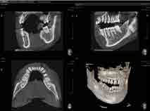 Pax-i 3D Smart Tomography - Immagini di alta qualità HIGH DEFINITION HD Image Quality Innovation Compressed Sensing Technology La qualità delle immagini 3D è superiore grazie all innovativo algoritmo