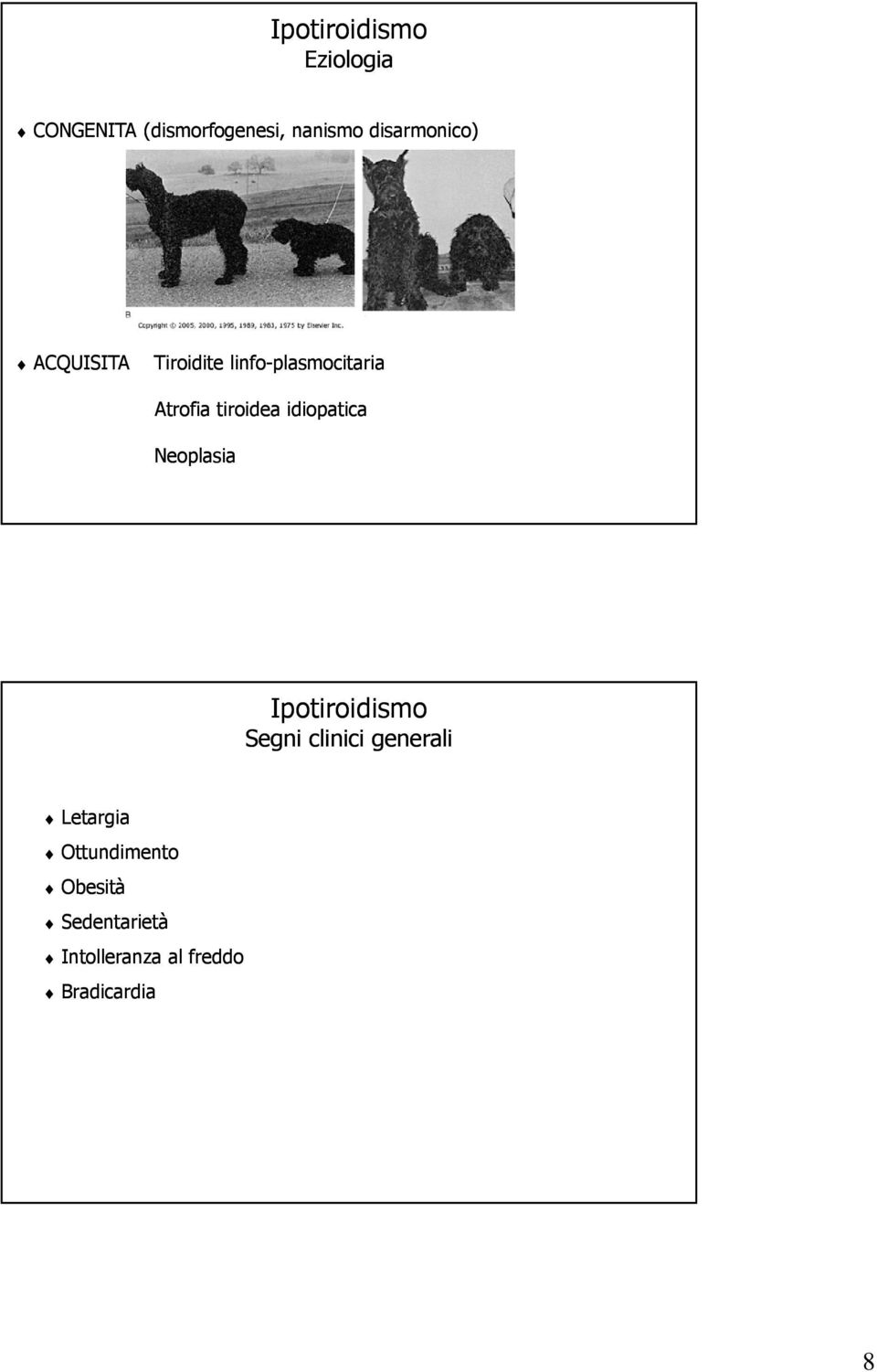 tiroidea idiopatica Neoplasia Ipotiroidismo Segni clinici generali