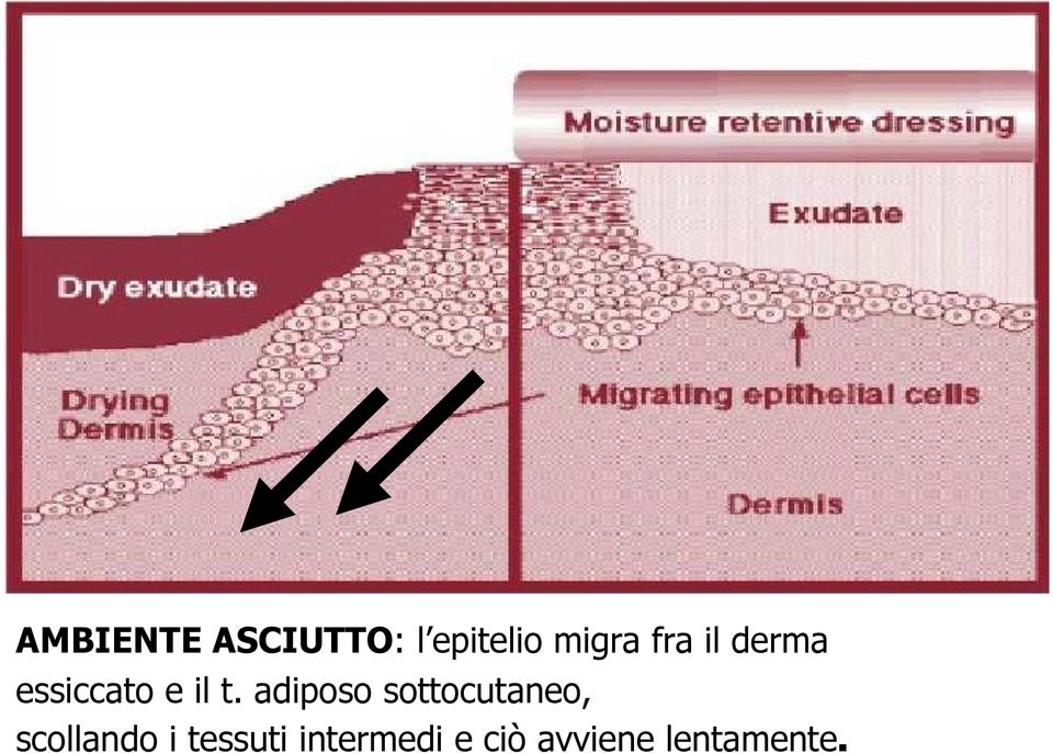 adiposo sottocutaneo, scollando i