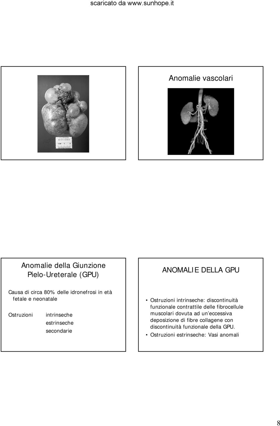 intrinseche: discontinuità funzionale contrattile delle fibrocellule muscolari dovuta ad un eccessiva