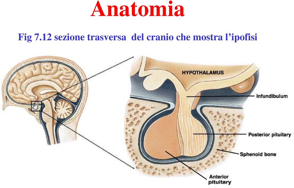 trasversa del