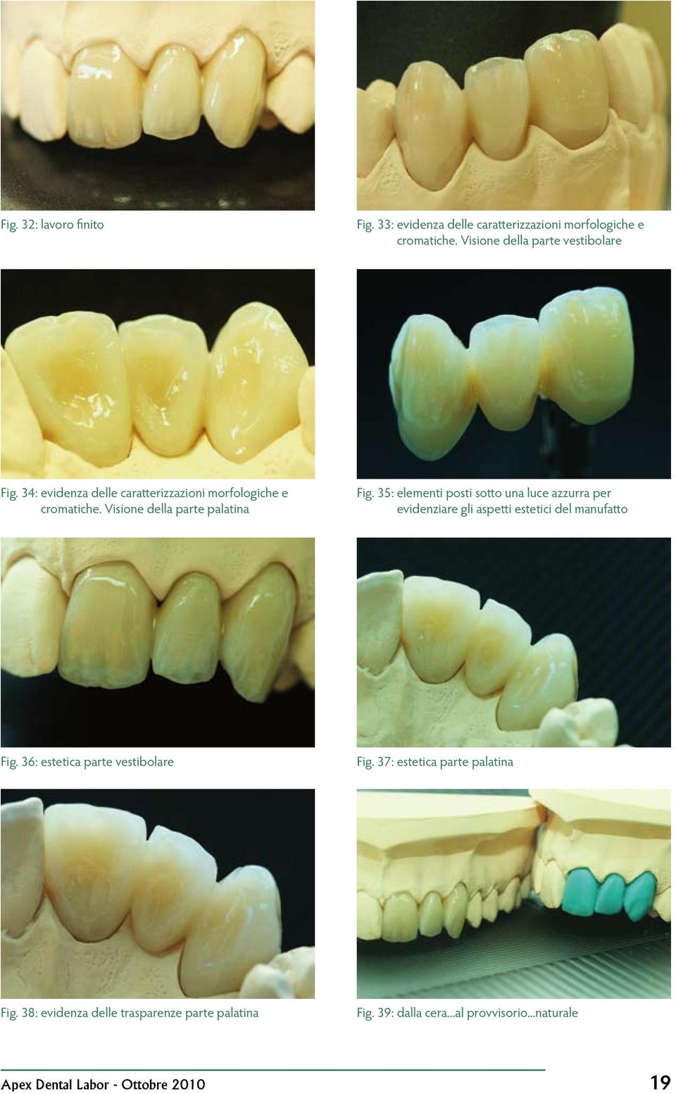 35: elementi posti sotto una luce azzurra per evidenziare gli aspetti estetici del manufatto Fig.