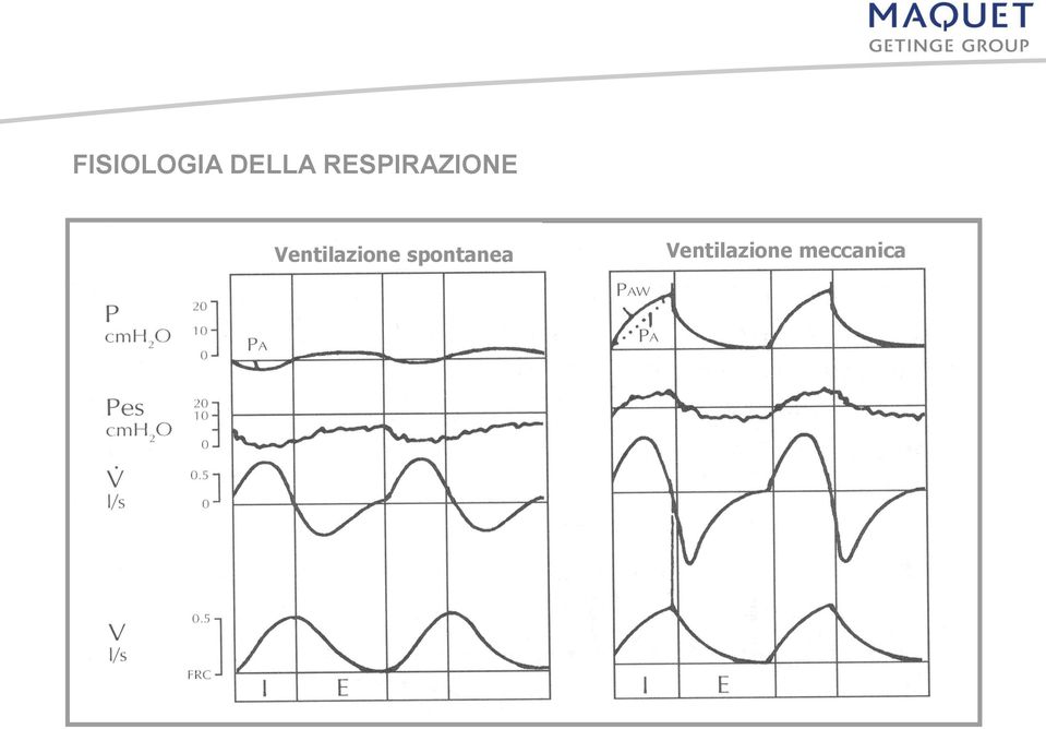 Ventilazione