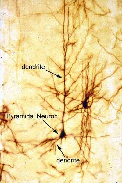 SLA: definizione La SLA è una malattia neurodegenerativa caratterizzata dalla