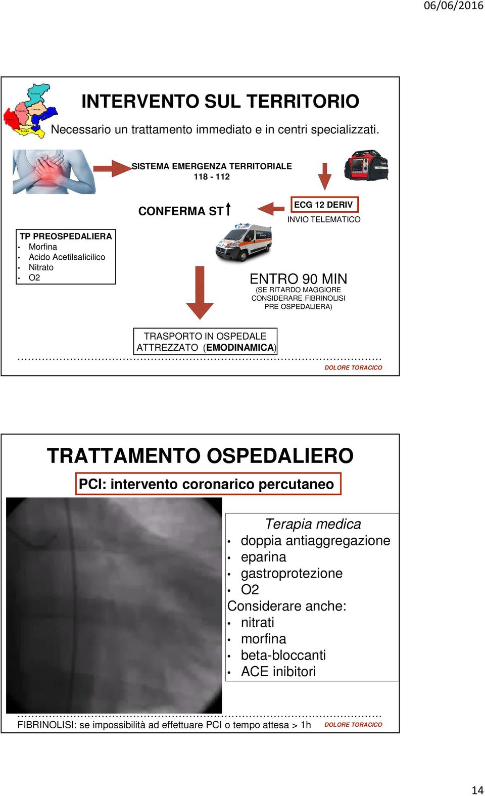 (SE RITARDO MAGGIORE CONSIDERARE FIBRINOLISI PRE OSPEDALIERA) TRASPORTO IN OSPEDALE ATTREZZATO (EMODINAMICA) TRATTAMENTO OSPEDALIERO PCI: intervento