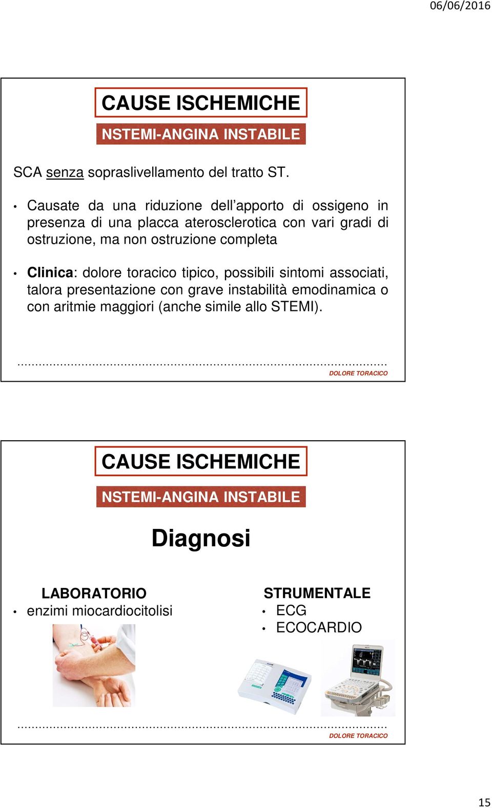 ostruzione, ma non ostruzione completa Clinica: dolore toracico tipico, possibili sintomi associati, talora